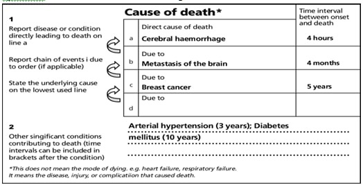 Image of a death certificate showing the cause of death sequence: Cerebral haemorrhage (4 hours) due to metastasis of the brain (4 months) due to breast cancer (5 years), with arterial hypertension and diabetes as contributory causes