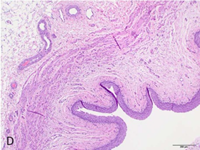 Histological section showing stellate lumen with transitional epithelium and smooth muscle layers - ureter