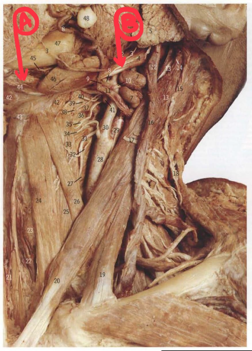 Dissection showing digastric muscle with anterior and posterior bellies labeled A and B