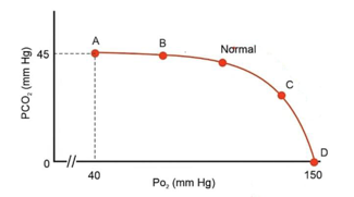 V/Q curve showing points A-D - Point D represents dead space (infinite V/Q ratio) in pulmonary embolism