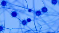 Lactophenol cotton blue mount showing small intracellular narrow-based budding yeast forms - Histoplasma capsulatum