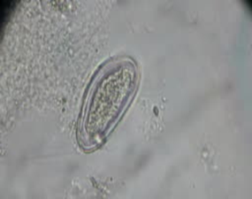 Microscopy image showing Enterobius vermicularis egg with characteristic D-shaped flattened side